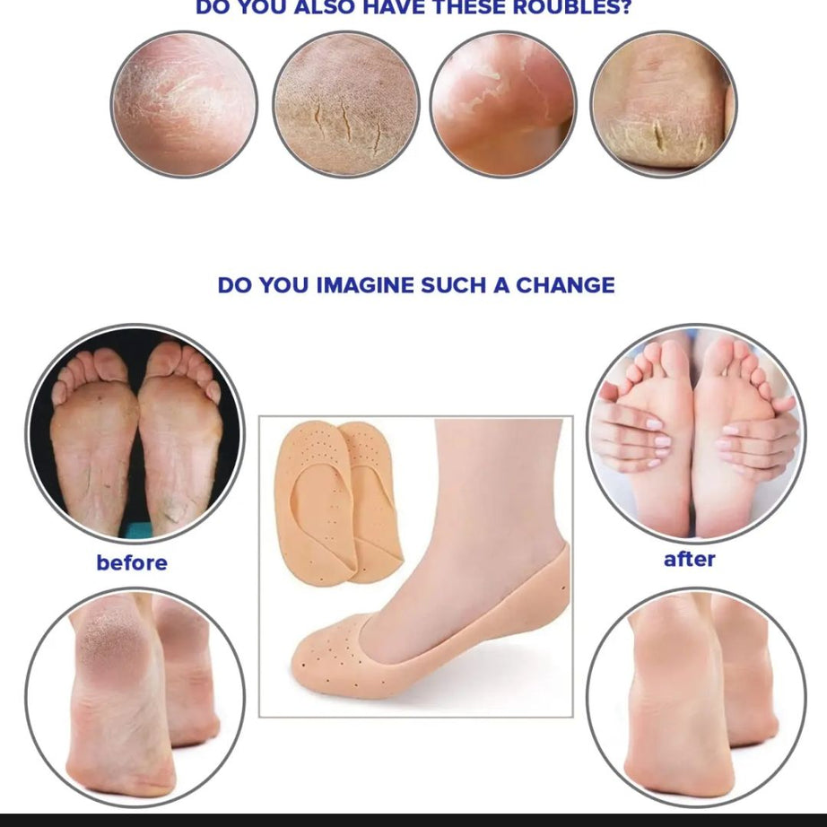 1Pair (2Pcs ) Silicone Feet Care Boat socks Moisturizing Gel Heel Socks with Pain Relief Crack Hole Cracked Foot Skin Care Protectors Foot Care Tool - Oshi.pk - Buy & Sell Online