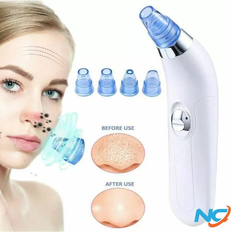Blackhead Removal Machine-Derma Suction 3 in 1 Black Head Remover Machine-Acne Pimple Pore Cleaner Vacuum Suction Tool - Oshi.pk - Buy & Sell Online