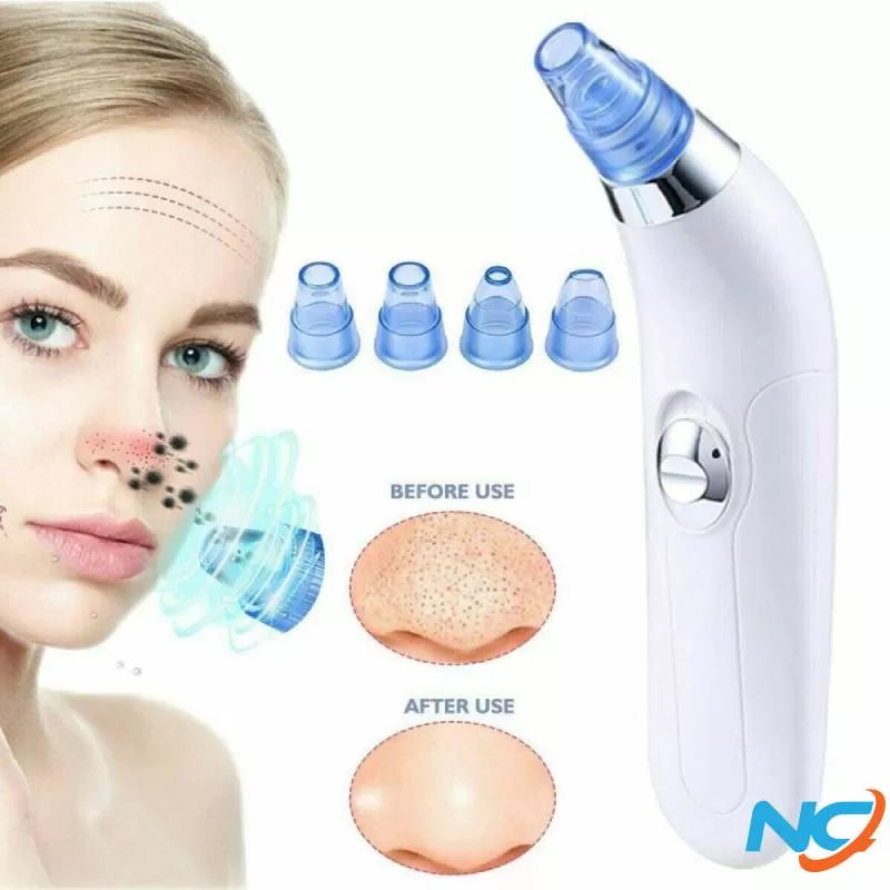 Blackhead Removal Machine-Derma Suction 3 in 1 Black Head Remover Machine-Acne Pimple Pore Cleaner Vacuum Suction Tool - Oshi.pk - Buy & Sell Online