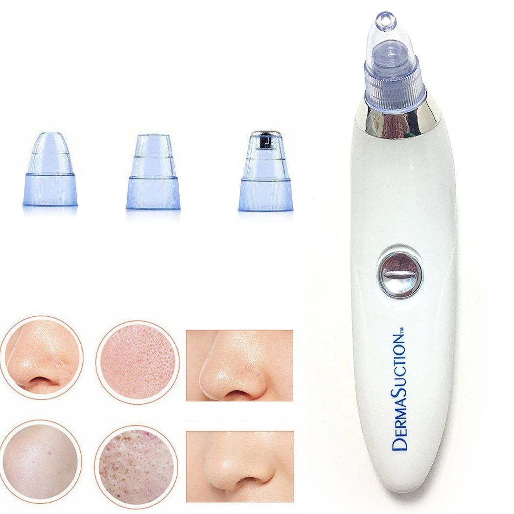 Cell Operated Blackhead Removal Machine Derma Suction 4 In 1 Black Head Remover Machine - Oshi.pk - Buy & Sell Online