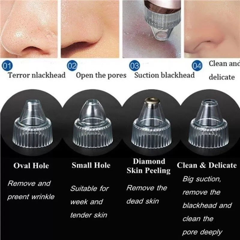 Chargeable Blackhead Removal Machine - 4 in 1 Black Head Remover Machine - Acne Pimple Pore Cleaner Vacuum Suction Tool Blackhead Removal On Nose Suck - Oshi.pk - Buy & Sell Online