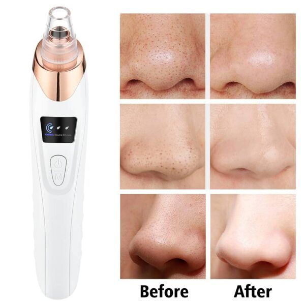 Electric Blackhead Acne Oil Remover Vacuum Suction Face Pore Cleaner Facial Beauty Equipment,Blackhead Removal Machine - Oshi.pk - Buy & Sell Online