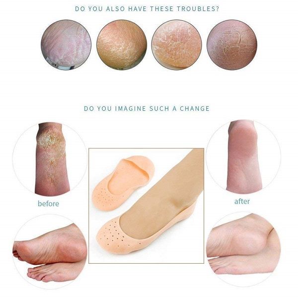 Full Length Silicone Foot Protector Moisturizing Socks - Oshi.pk - Buy & Sell Online