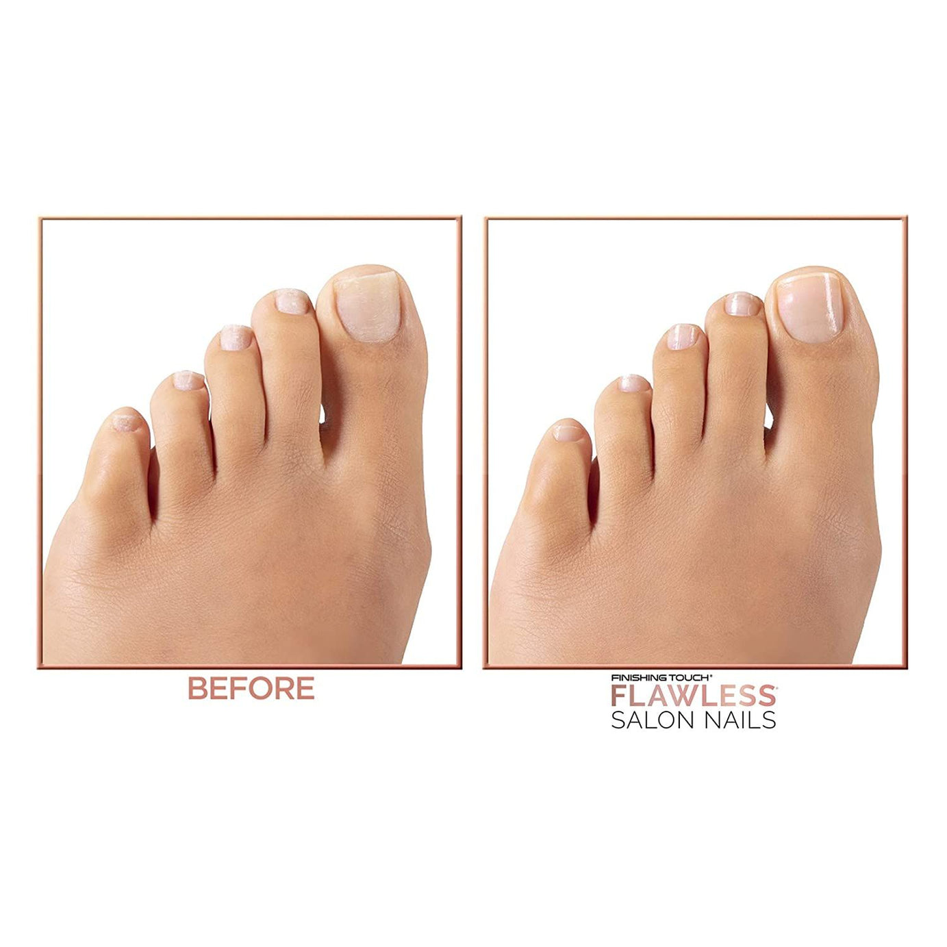 Rechargeable Flawless Salon Nail Pro Electric Nail Drill Bits File Tool Set Machine Grinding Manicure Pen Manicure Pedicure Cuticle Clean Remover - Oshi.pk - Buy & Sell Online