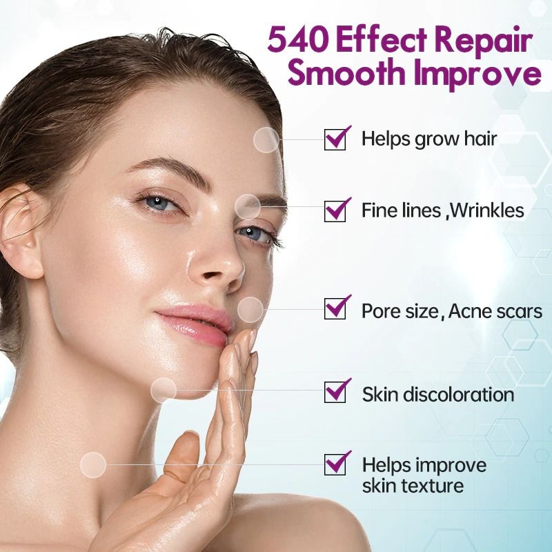 Skin Therapy 0.5 Derma Roller With 540 Micro Needle Face Care Titanium Hair Regrowth Beard Growth Anti Hair Loss Treatment Unisex - Oshi.pk - Buy & Sell Online