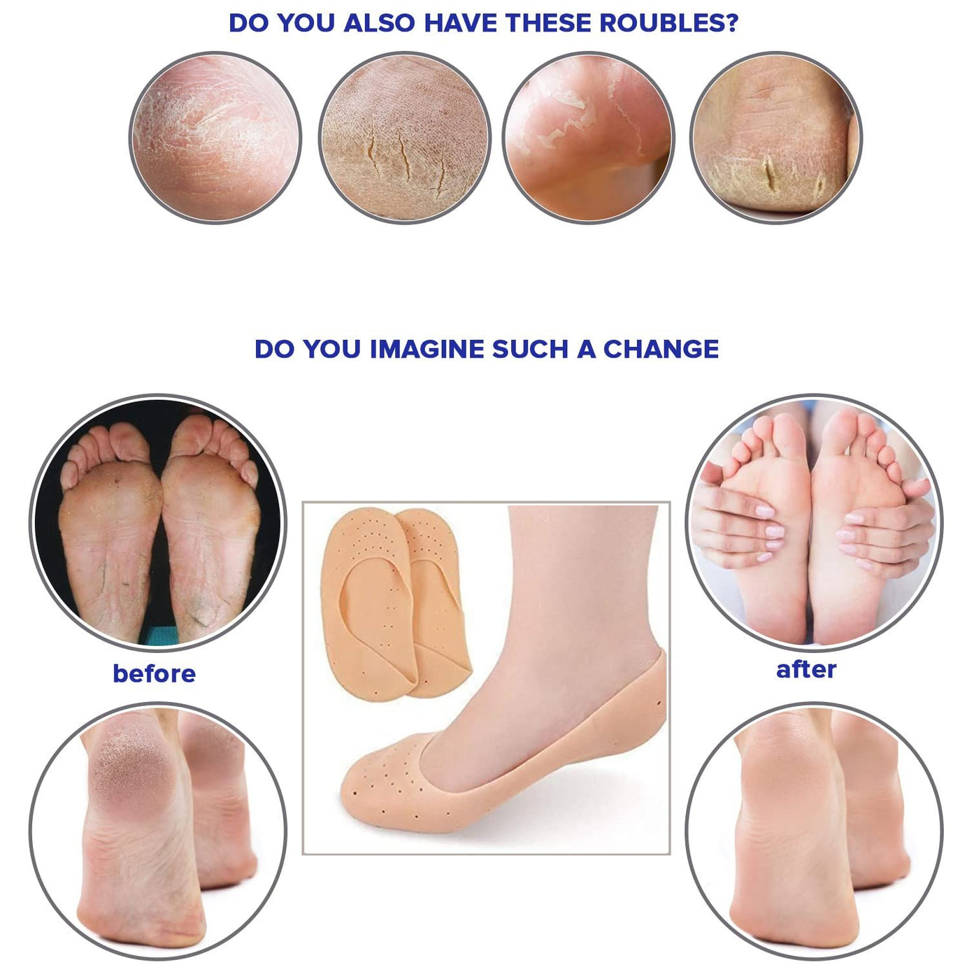 1Pair (2Pcs ) Silicone Feet Care Boat socks Moisturizing Gel Heel Socks with Pain Relief Crack Hole Cracked Foot Skin Care Protectors Foot Care Tool - Oshi.pk - Buy & Sell Online