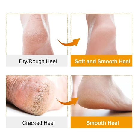 1Pair (2Pcs ) Silicone Feet Care Boat socks Moisturizing Gel Heel Socks with Pain Relief Crack Hole Cracked Foot Skin Care Protectors Foot Care Tool - Oshi.pk - Buy & Sell Online