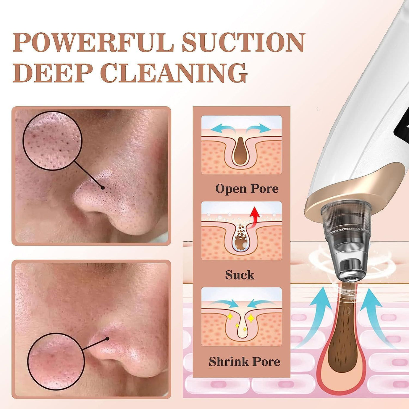5 in 1 Blackhead Remover machine Pore Vacuum- Electric Facial Pore Cleaner Acne WhiteHead, blackhead vacuum machine , dust remover, dirt remover, Pimp - Oshi.pk - Buy & Sell Online