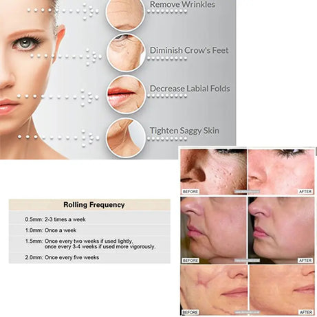 Derma Roller - Smoothen Skin & Reduce Fine Lines - Oshi.pk - Buy & Sell Online