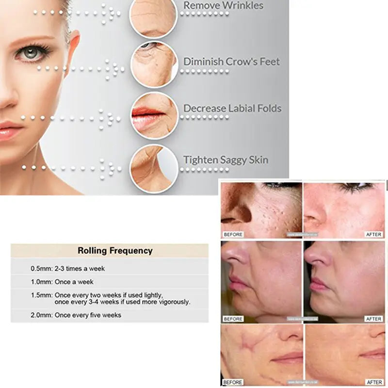 Derma Roller - Smoothen Skin & Reduce Fine Lines - Oshi.pk - Buy & Sell Online