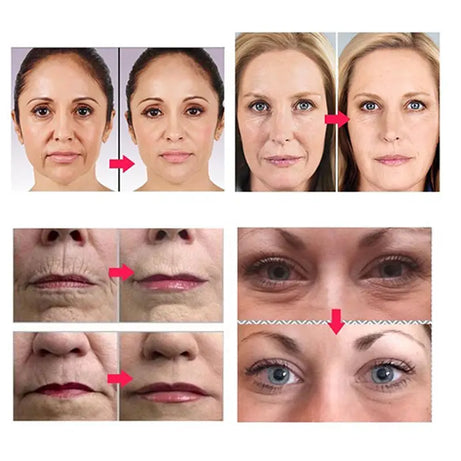 Derma Roller - Smoothen Skin & Reduce Fine Lines - Oshi.pk - Buy & Sell Online