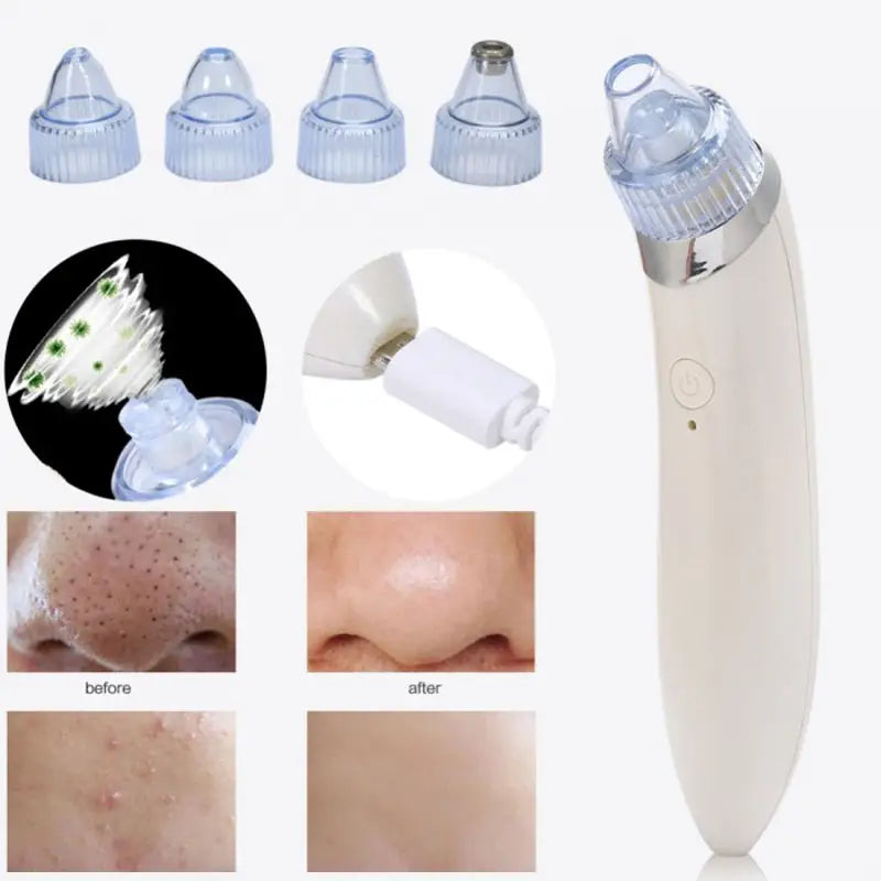 Rechargeable Electric Suck Blackhead Removal, Dead Skin Acne Remove & Skin Pore Cleaner - Oshi.pk - Buy & Sell Online