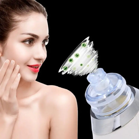 Rechargeable Electric Suck Blackhead Removal, Dead Skin Acne Remove & Skin Pore Cleaner - Oshi.pk - Buy & Sell Online