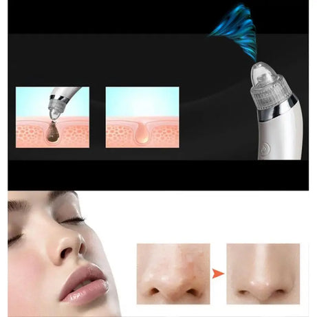 Rechargeable Electric Suck Blackhead Removal, Dead Skin Acne Remove & Skin Pore Cleaner - Oshi.pk - Buy & Sell Online