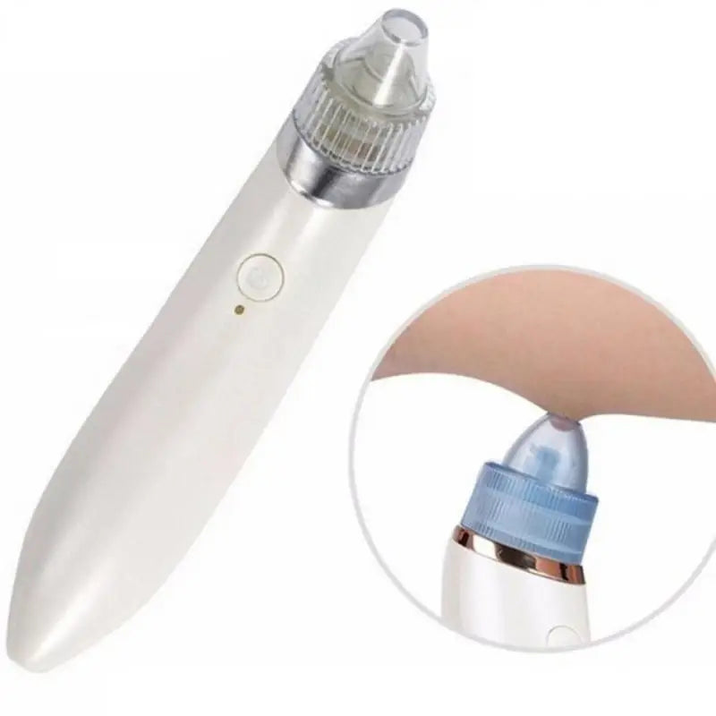 Rechargeable Electric Suck Blackhead Removal, Dead Skin Acne Remove & Skin Pore Cleaner - Oshi.pk - Buy & Sell Online