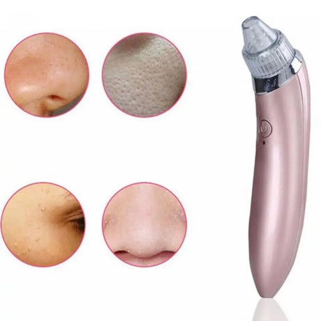 Rechargeable Electric Suck Blackhead Removal, Dead Skin Acne Remove & Skin Pore Cleaner - Oshi.pk - Buy & Sell Online