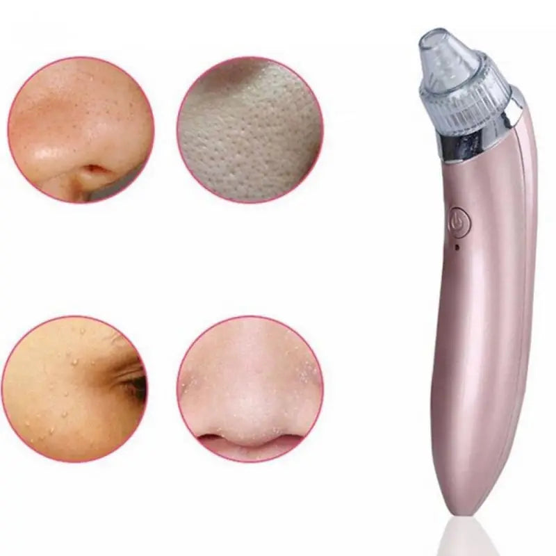Rechargeable Electric Suck Blackhead Removal, Dead Skin Acne Remove & Skin Pore Cleaner - Oshi.pk - Buy & Sell Online