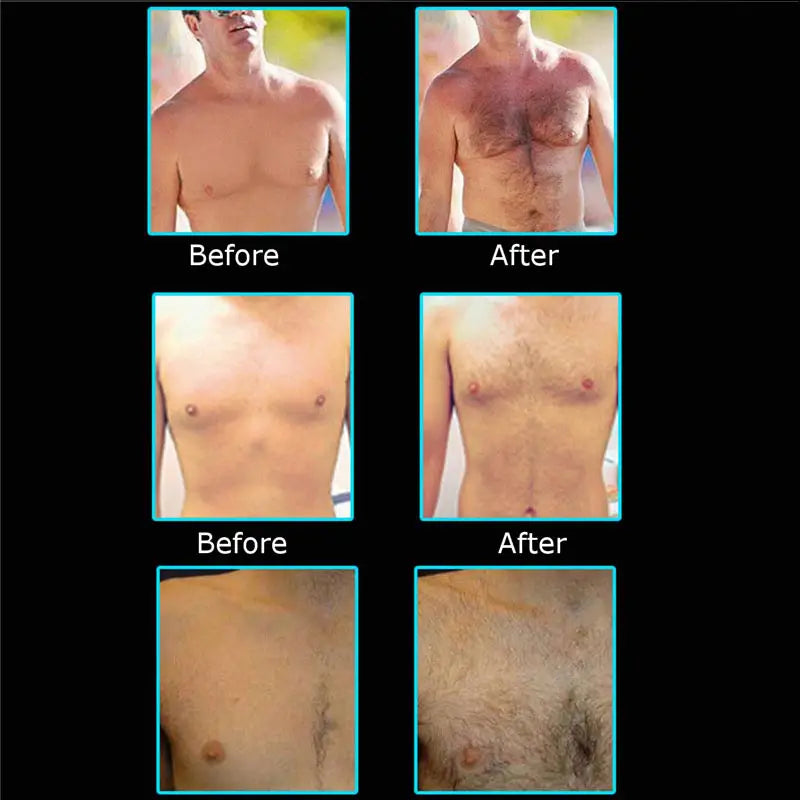 Hair & Beard Growth Essential Oil Enhance Facial Whiskers Nutrition Moustache - Oshi.pk - Buy & Sell Online