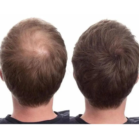 DEXE CABOKI Hair Building Fibers | Fake Hairs - Oshi.pk - Buy & Sell Online