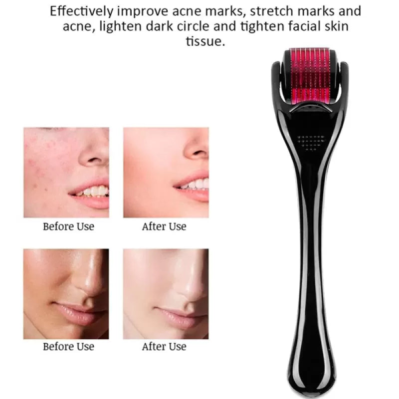 DRS540 needles derma roller microneedle for skin care and body treatment 0.5mm - Oshi.pk - Buy & Sell Online