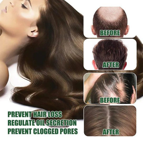 7 Days Herbal Hair Growth Serum - Oshi.pk - Buy & Sell Online
