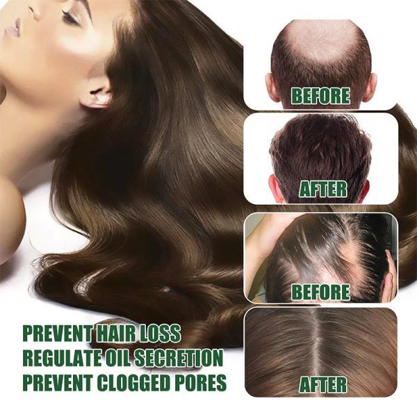 7 Days Herbal Hair Growth Serum - Oshi.pk - Buy & Sell Online