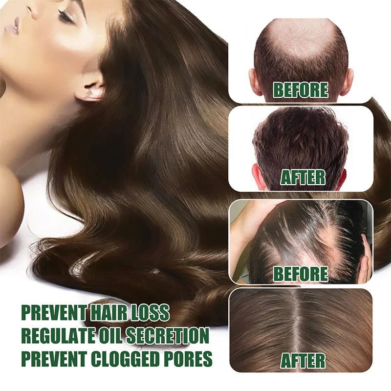 7 Days Herbal Hair Growth Serum - Oshi.pk - Buy & Sell Online