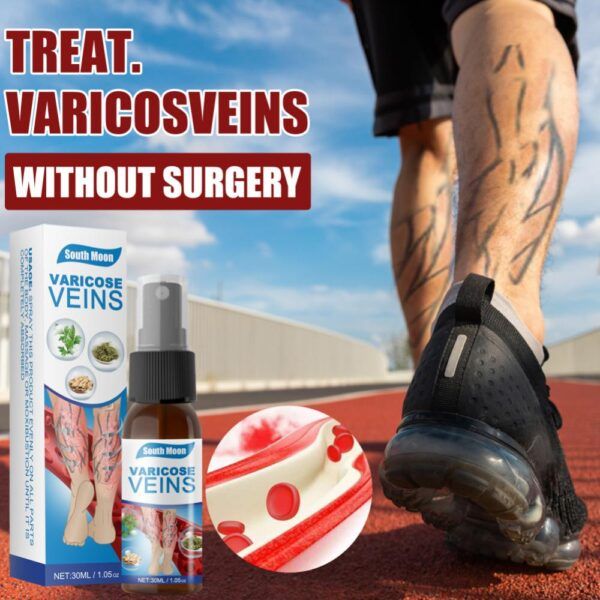 Back & Legs Relief Vericose Veins Treatment Spray - Oshi.pk - Buy & Sell Online