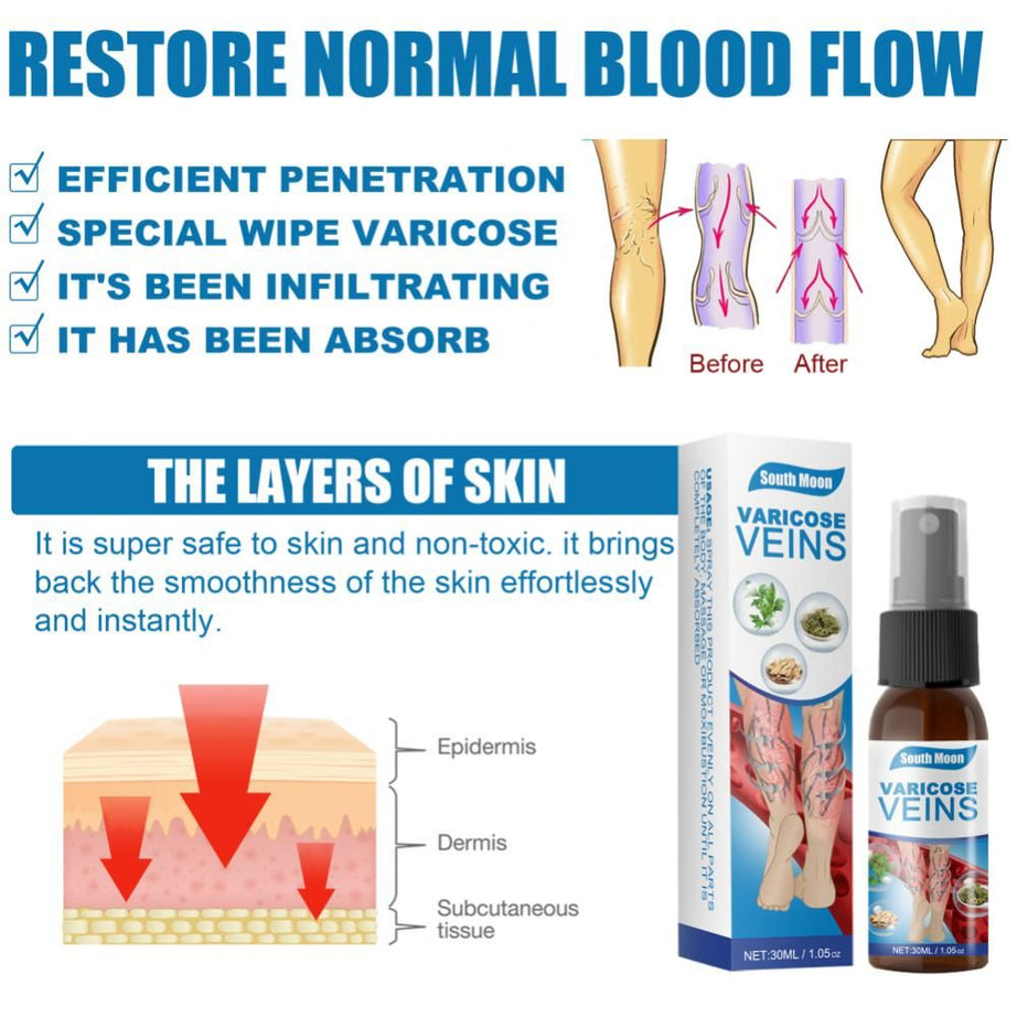Back & Legs Relief Vericose Veins Treatment Spray - Oshi.pk - Buy & Sell Online
