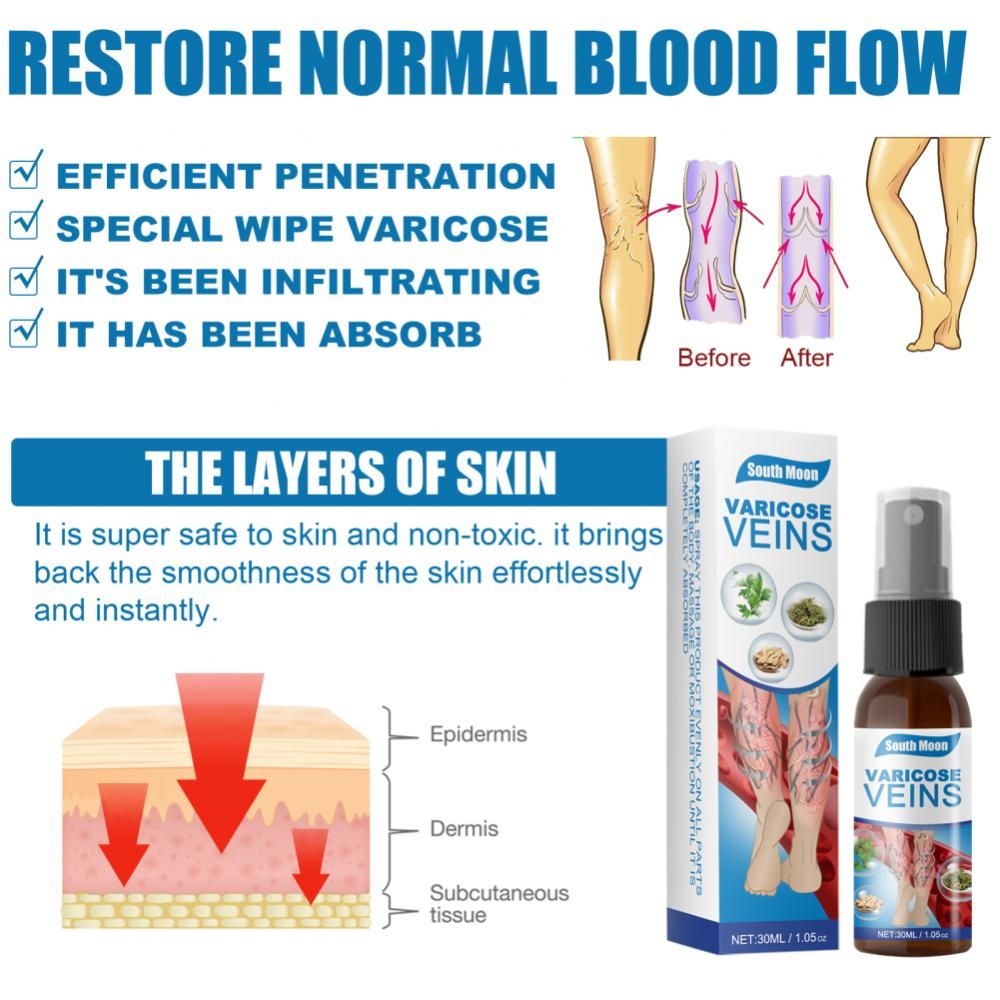 Back & Legs Relief Vericose Veins Treatment Spray - Oshi.pk - Buy & Sell Online