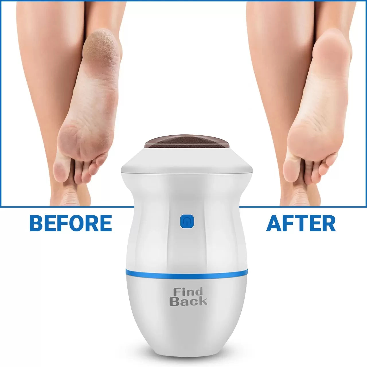 Best Quality Foot Pedicure Grinder Remover and Nail Filler Tools - Foot Grinder for Dead Skin - Electric Foot Grinder Replacement Automatic Polisher a - Oshi.pk - Buy & Sell Online