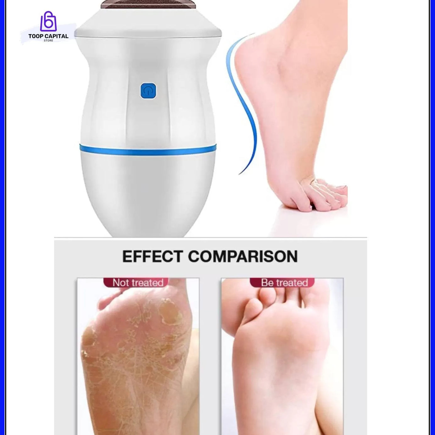 Best Quality Foot Pedicure Grinder Remover and Nail Filler Tools - Foot Grinder for Dead Skin - Electric Foot Grinder Replacement Automatic Polisher a - Oshi.pk - Buy & Sell Online