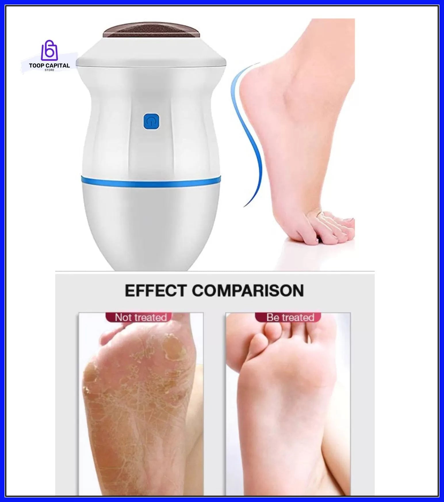 Best Quality Foot Pedicure Grinder Remover and Nail Filler Tools - Foot Grinder for Dead Skin - Electric Foot Grinder Replacement Automatic Polisher a - Oshi.pk - Buy & Sell Online