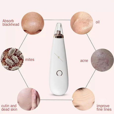 Blackhead Removal Machine Derma Suction 3 in 1 Black Head Remover Machine - Oshi.pk - Buy & Sell Online