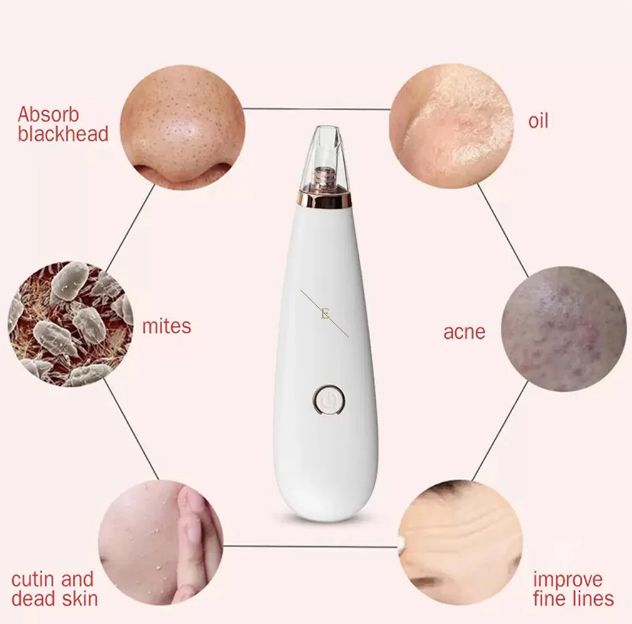 Blackhead Removal Machine Derma Suction 3 in 1 Black Head Remover Machine - Oshi.pk - Buy & Sell Online