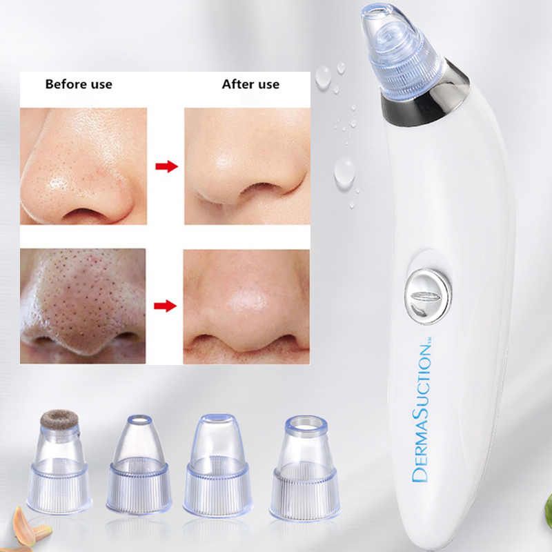 Blackhead Removal Machine-Derma Suction 3 In 1 Black Head Remover Machine-Acne Pimple Pore Cleaner Vacuum Suction Tool - Oshi.pk - Buy & Sell Online