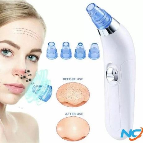 Blackhead Removal Machine-Derma Suction 3 In 1 Black Head Remover Machine-Acne Pimple Pore Cleaner Vacuum Suction Tool - Oshi.pk - Buy & Sell Online