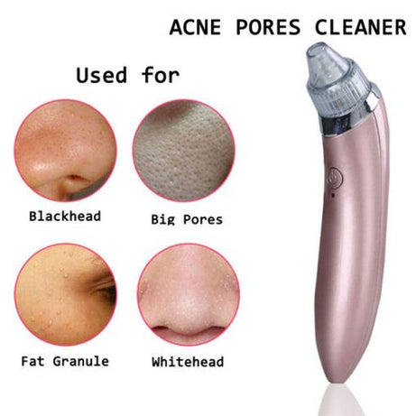 Blackhead Remover Vacuum Pore Cleaner tool suction device with Rechargeable Battery