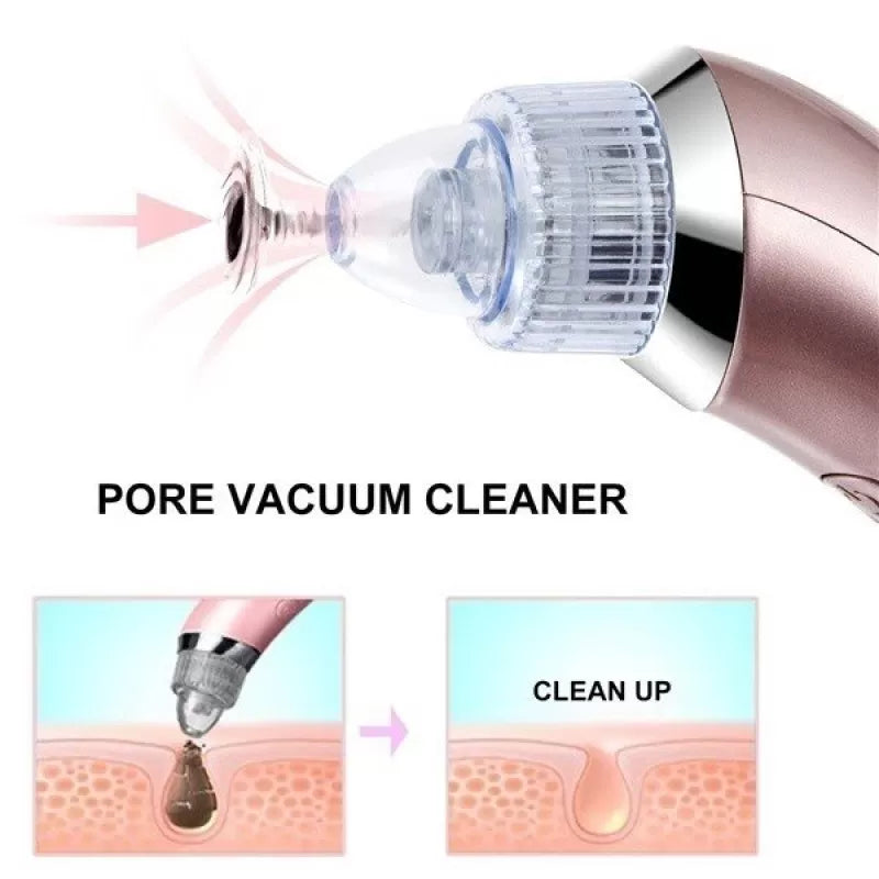 Chargeable Blackhead Removal Machine - 4 in 1 Black Head Remover Machine - Acne Pimple Pore Cleaner Vacuum Suction Tool Blackhead Removal On Nose Suck - Oshi.pk - Buy & Sell Online