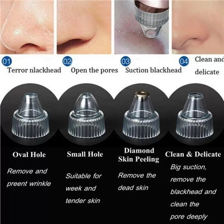 Chargeable Blackhead Removal Machine - 4 in 1 Black Head Remover Machine - Acne Pimple Pore Cleaner Vacuum Suction Tool Blackhead Removal On Nose Suck - Oshi.pk - Buy & Sell Online