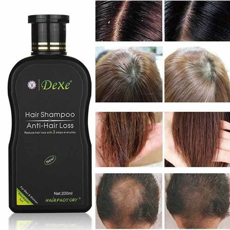 Dexe Anti Hair Loss Shampoo 200 ML - Oshi.pk - Buy & Sell Online