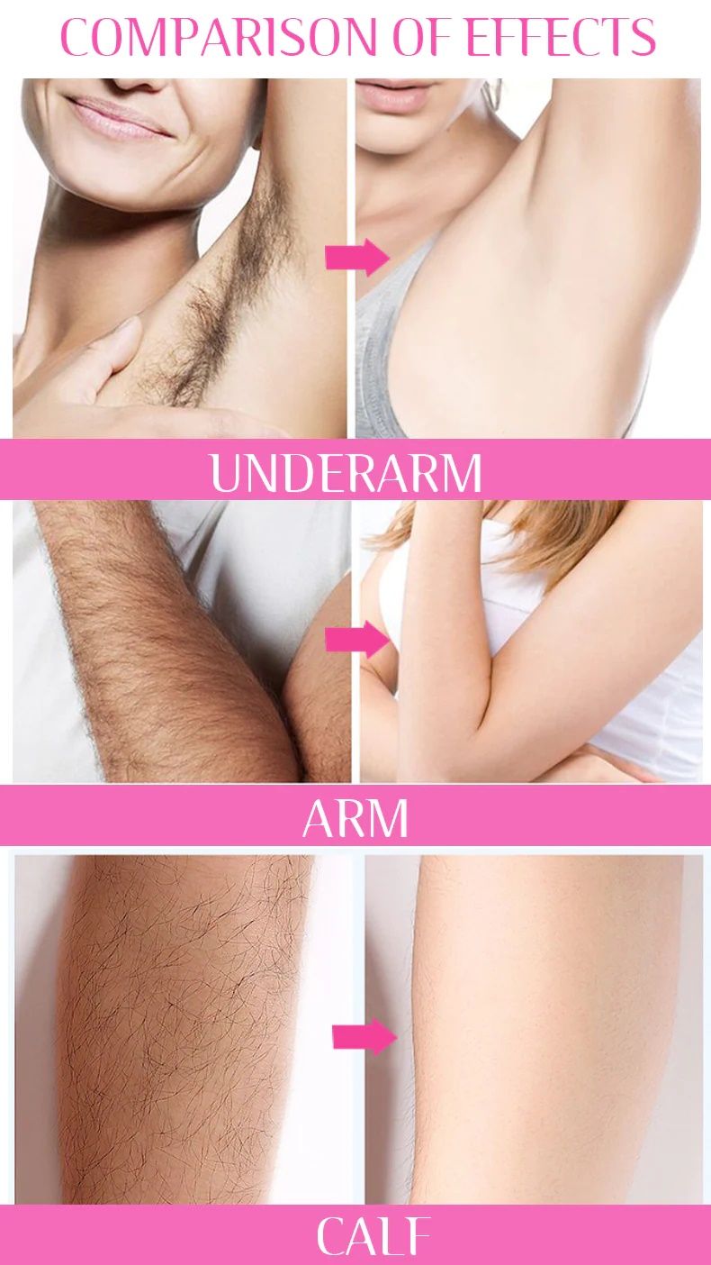 DISAAR 3-Minute Quick Legs Armpit Private Parts And Body Best Hair Removal Cream For Men Women - Oshi.pk - Buy & Sell Online