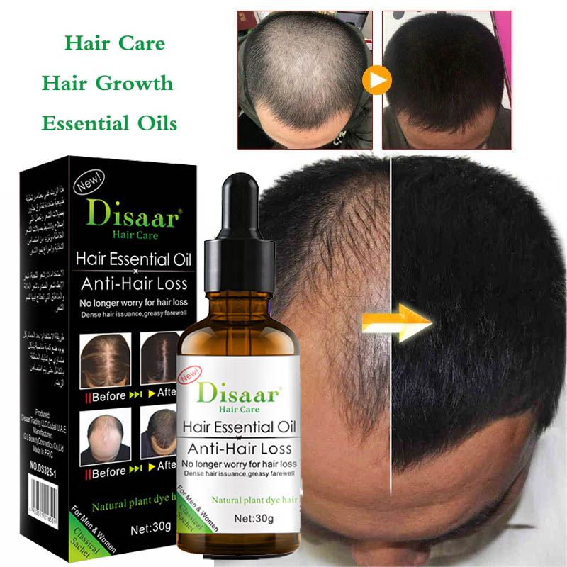 DISAAR Hair Growth Essential Oil Anti Hair Loss Treatment 30ml DS325-1 - Oshi.pk - Buy & Sell Online
