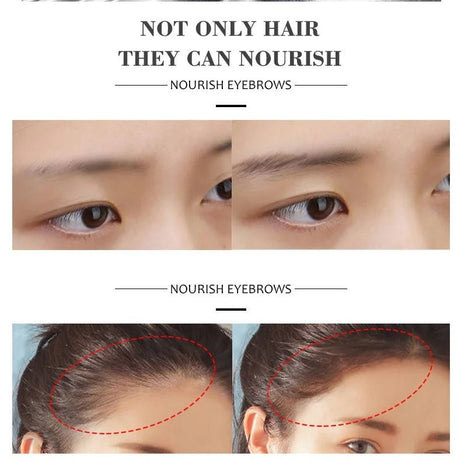 DISAAR Hair Growth Essential Oil Anti Hair Loss Treatment 30ml DS325-1 - Oshi.pk - Buy & Sell Online