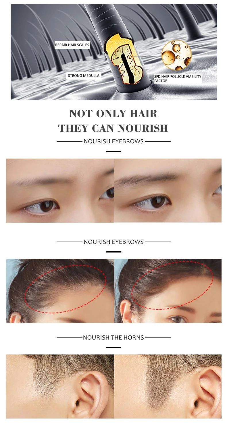 DISAAR Hair Growth Essential Oil Anti Hair Loss Treatment 30ml DS325-1 - Oshi.pk - Buy & Sell Online