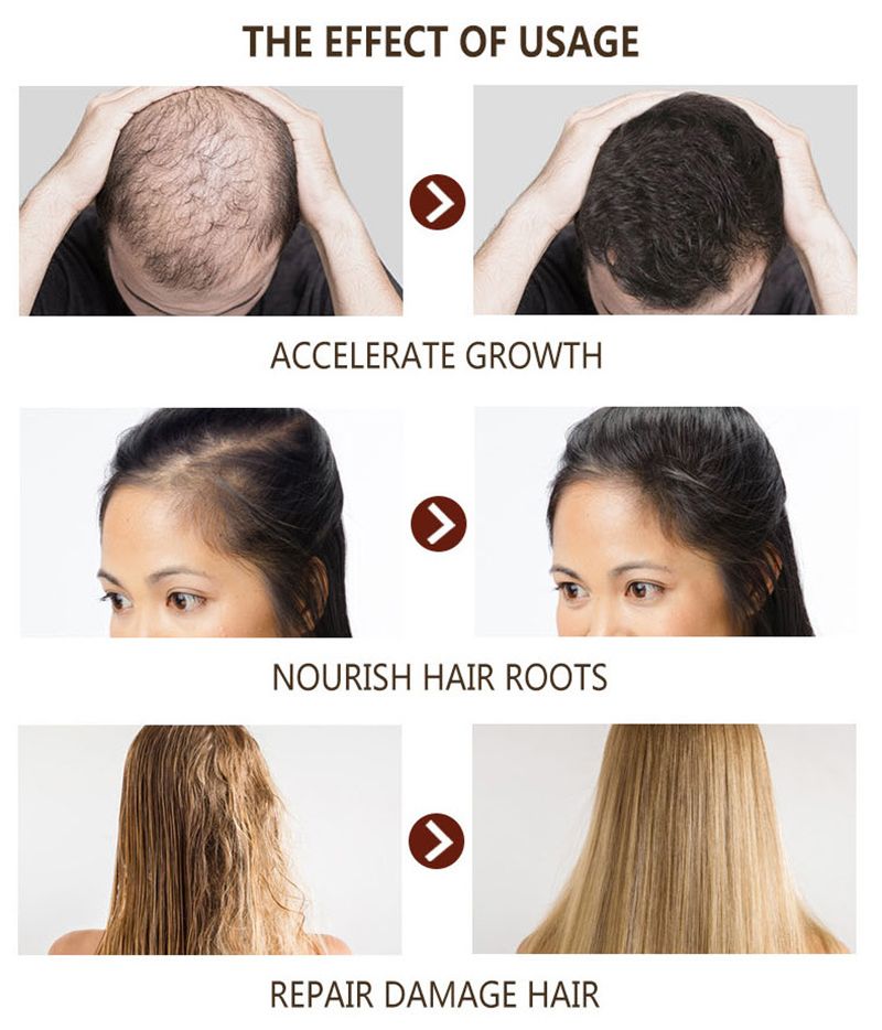 Disaar Natural Ginger Hair Care For Men And Women Hair Loss Powerful Hair Growth 30ML DS325-2 - Oshi.pk - Buy & Sell Online