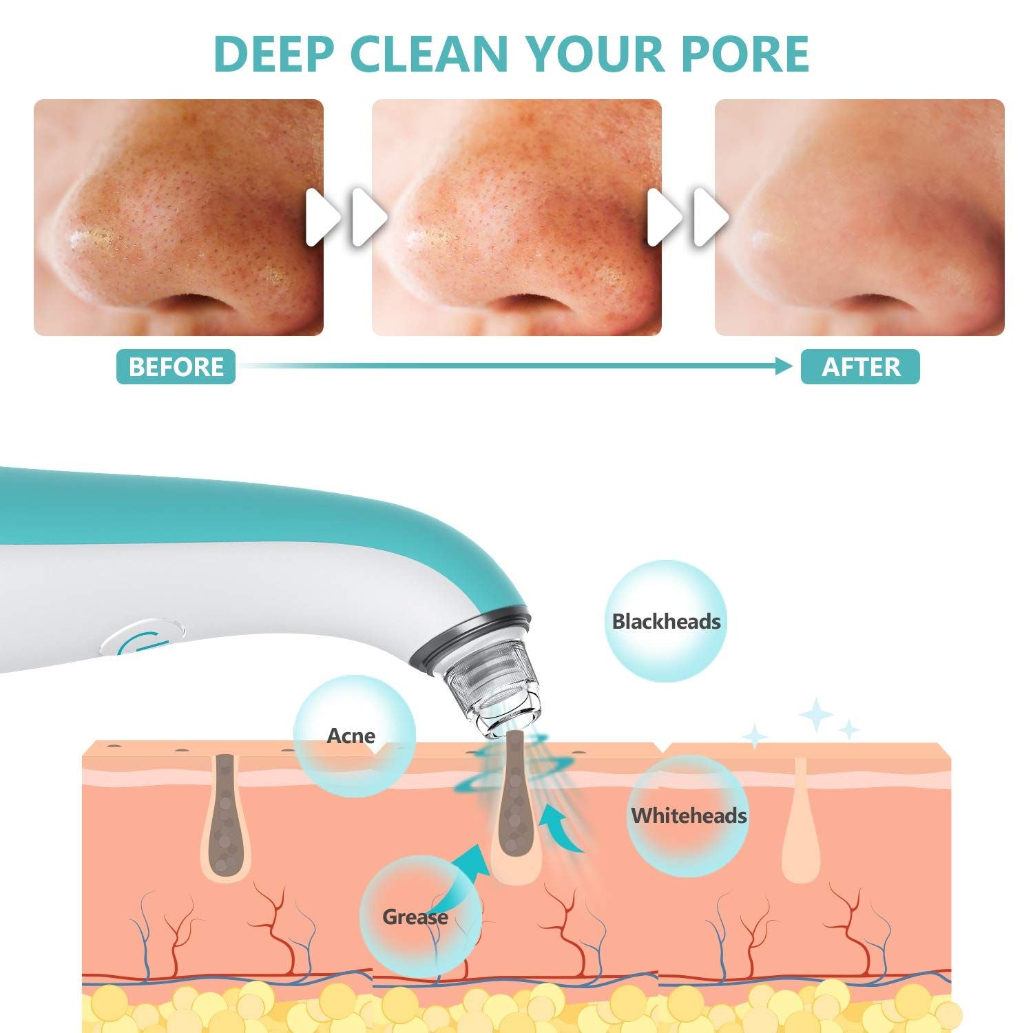 Electric Rechargeable Blackhead Acne Oil Remover Vacuum Nose Suction Face Pore Cleaner Facial Beauty Equipment Nose Blackhead Removal - Oshi.pk - Buy & Sell Online