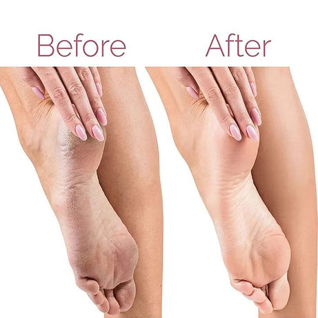 Electric Foot File For Heels Grinding Pedicure Tools Callus Remover USB Rechargeable Professional Foot Care Tool Dead Hard Skin