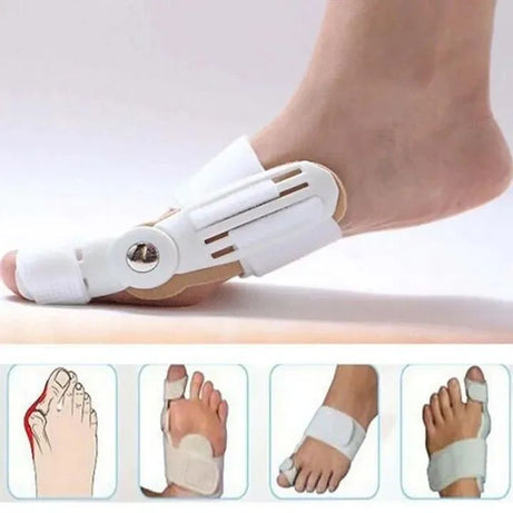 Foot Bone Correction for Relief of Thumb Valgus Toe Corrector Night Toe Splitter Adjustment Toe Foot Tool Bunion Splint - Oshi.pk - Buy & Sell Online
