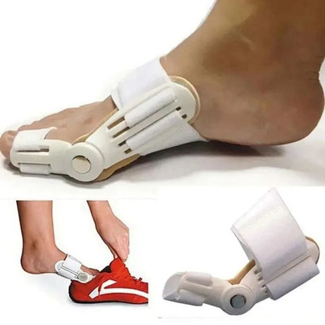 Foot Bone Correction for Relief of Thumb Valgus Toe Corrector Night Toe Splitter Adjustment Toe Foot Tool Bunion Splint - Oshi.pk - Buy & Sell Online
